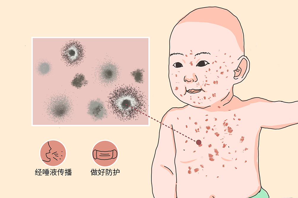 绍兴试管代怀孕公司